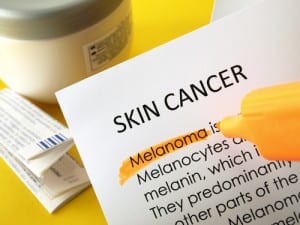Treating Skin Cancer