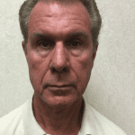 Male Cosmetic Surgery 10 After Thumbnail Photo