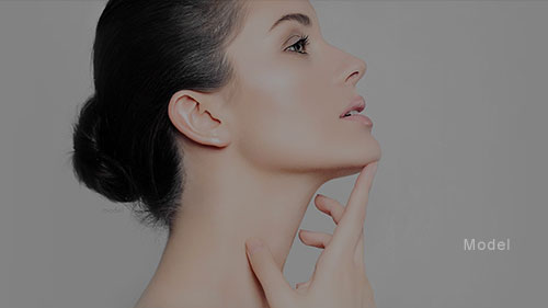 Facial Liposuction 