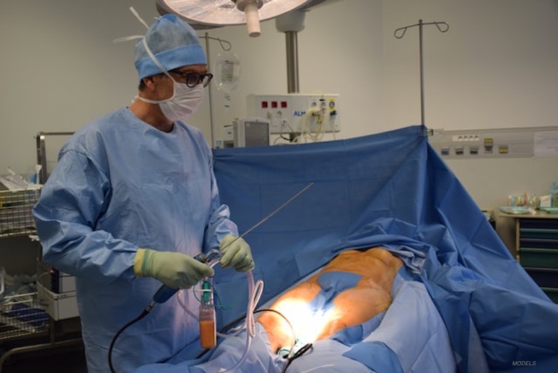 A surgeon in a scrub doing liposuction on a woman.