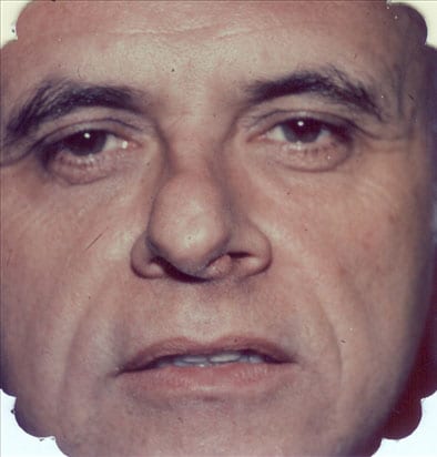 Male-Cosmetic-Surgery-01 | Before Male Cosmetic Surgery 2