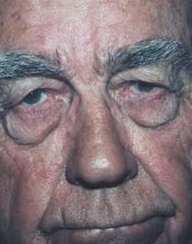 Male-Cosmetic-Surgery-03 | Before Body