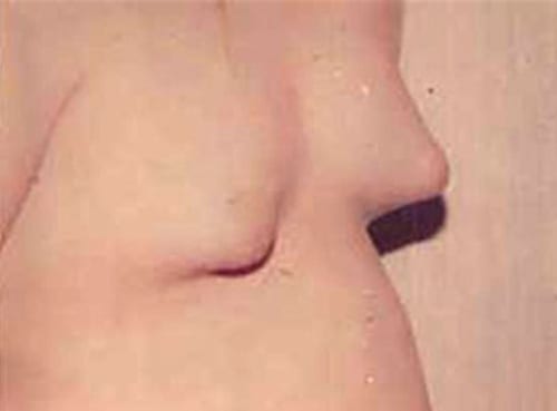 Male-Cosmetic-Surgery-07 | Before Male Cosmetic Surgery